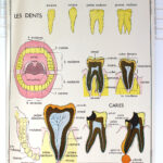 Photo 1 - Affiche Dents et Digestion