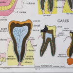 Photo 3 - Affiche Dents et Digestion