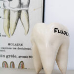 Photo 6 - Dent Fluocaril